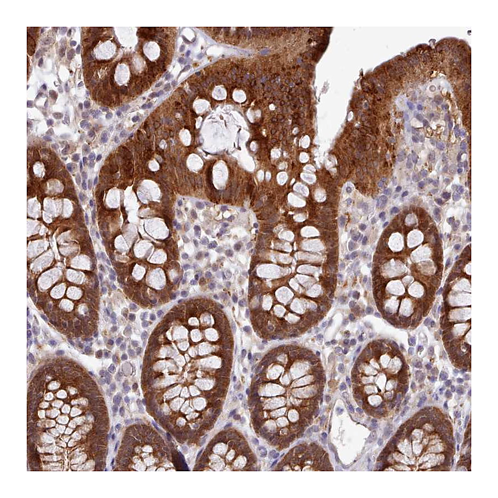 Atlas Antibodies Anti-CES3 Antibody