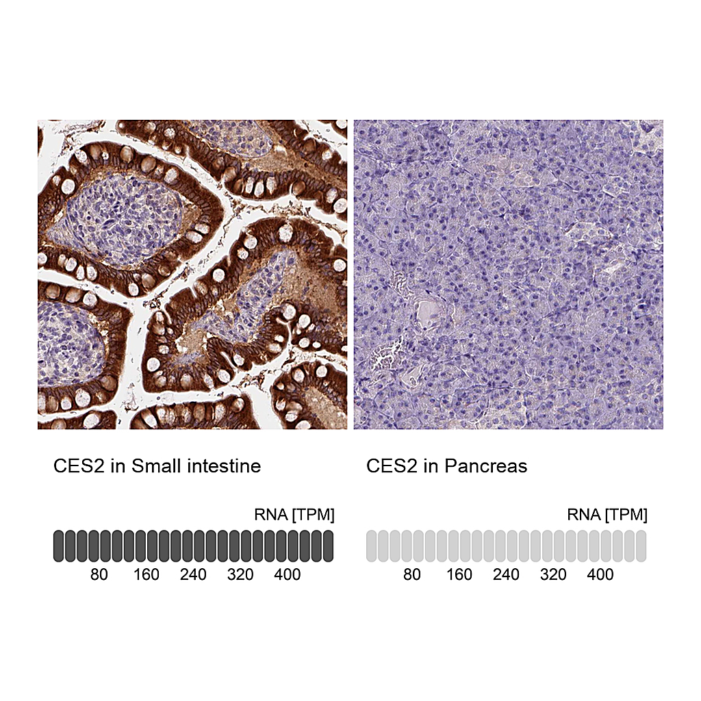 Atlas Antibodies Anti-CES2 Antibody