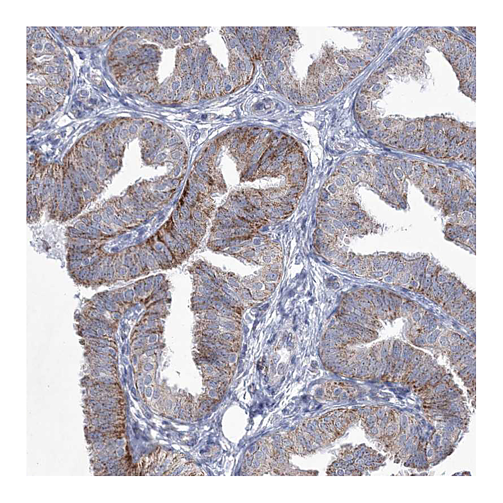 Atlas Antibodies Anti-CES4A Antibody