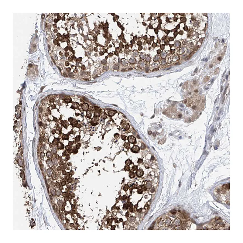 Atlas Antibodies Anti-CETN1 Antibody