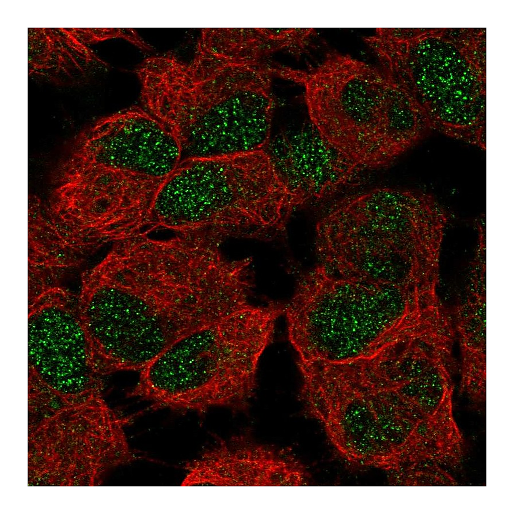 Atlas Antibodies Anti-CERS6 Antibody