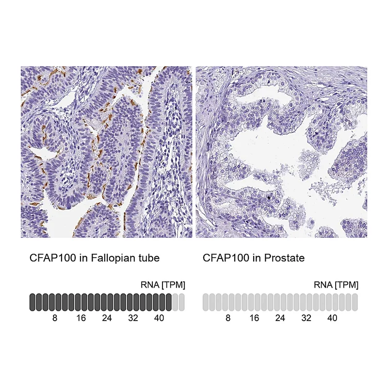 Atlas Antibodies Anti-CFAP100 Antibody