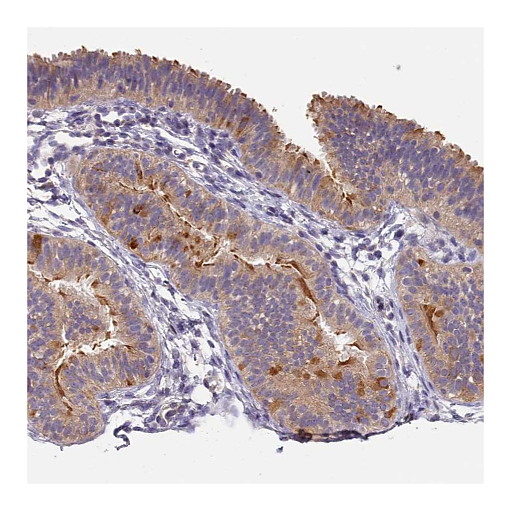 Atlas Antibodies Anti-CFAP161 Antibody