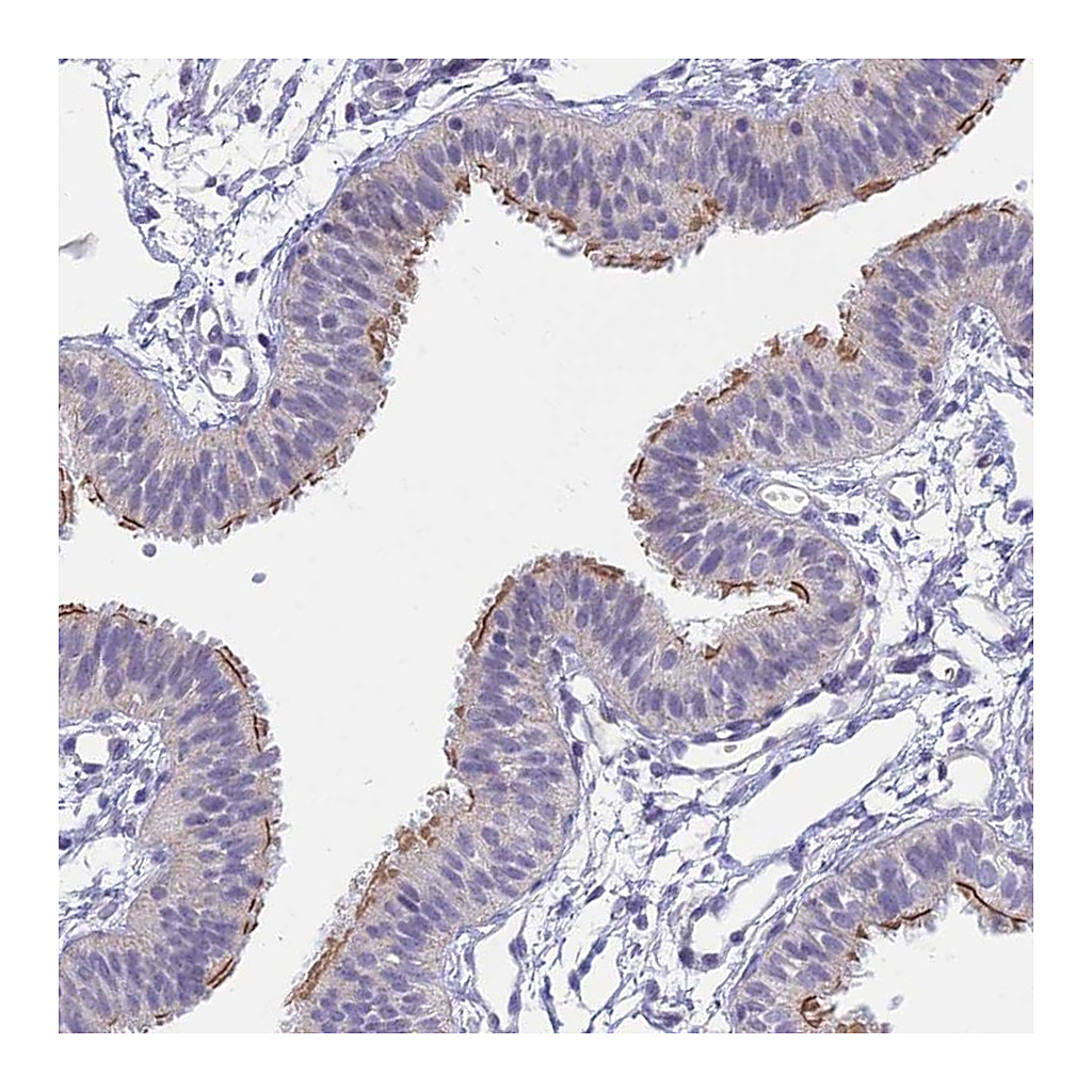 Atlas Antibodies Anti-CFAP206 Antibody