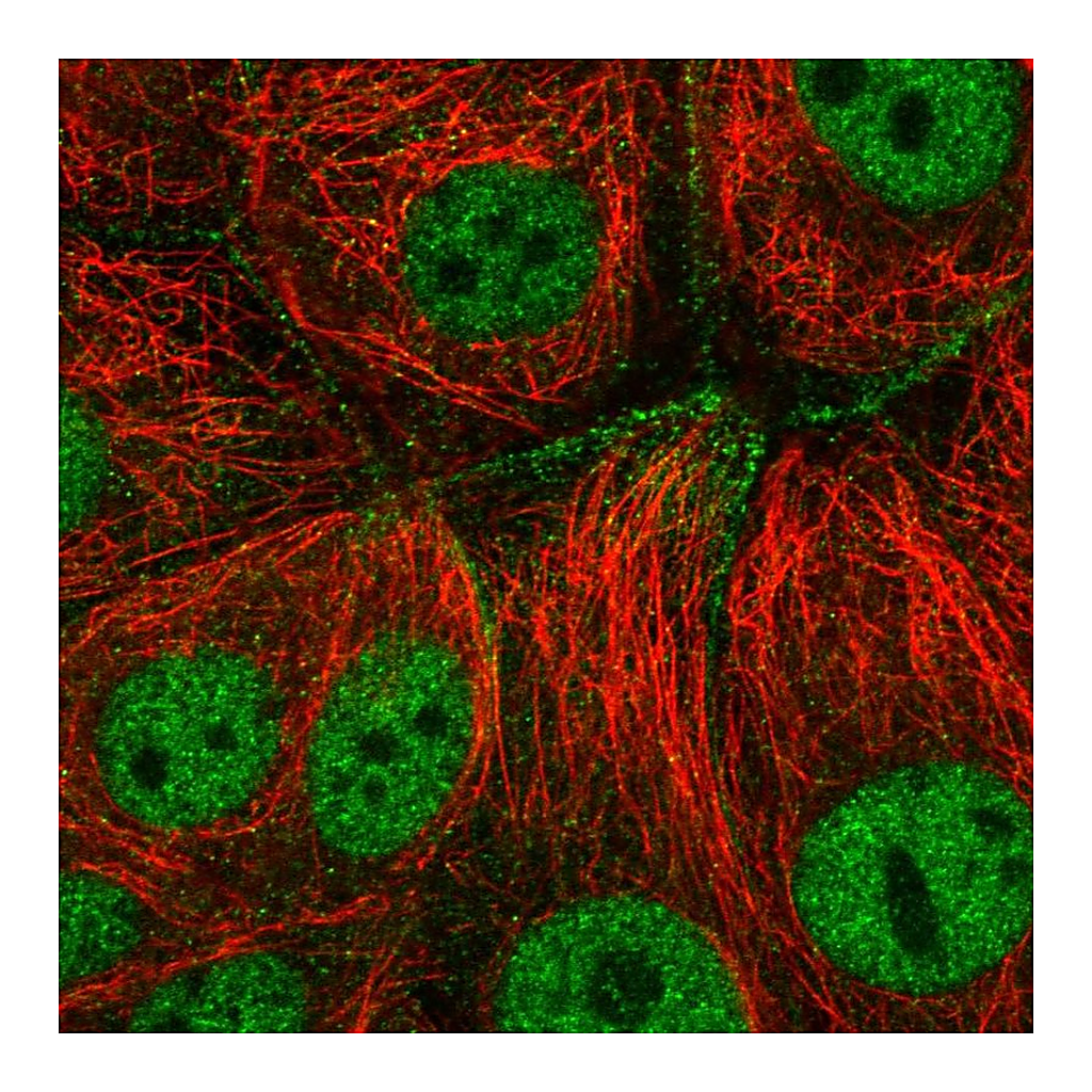 Atlas Antibodies Anti-CFAP206 Antibody