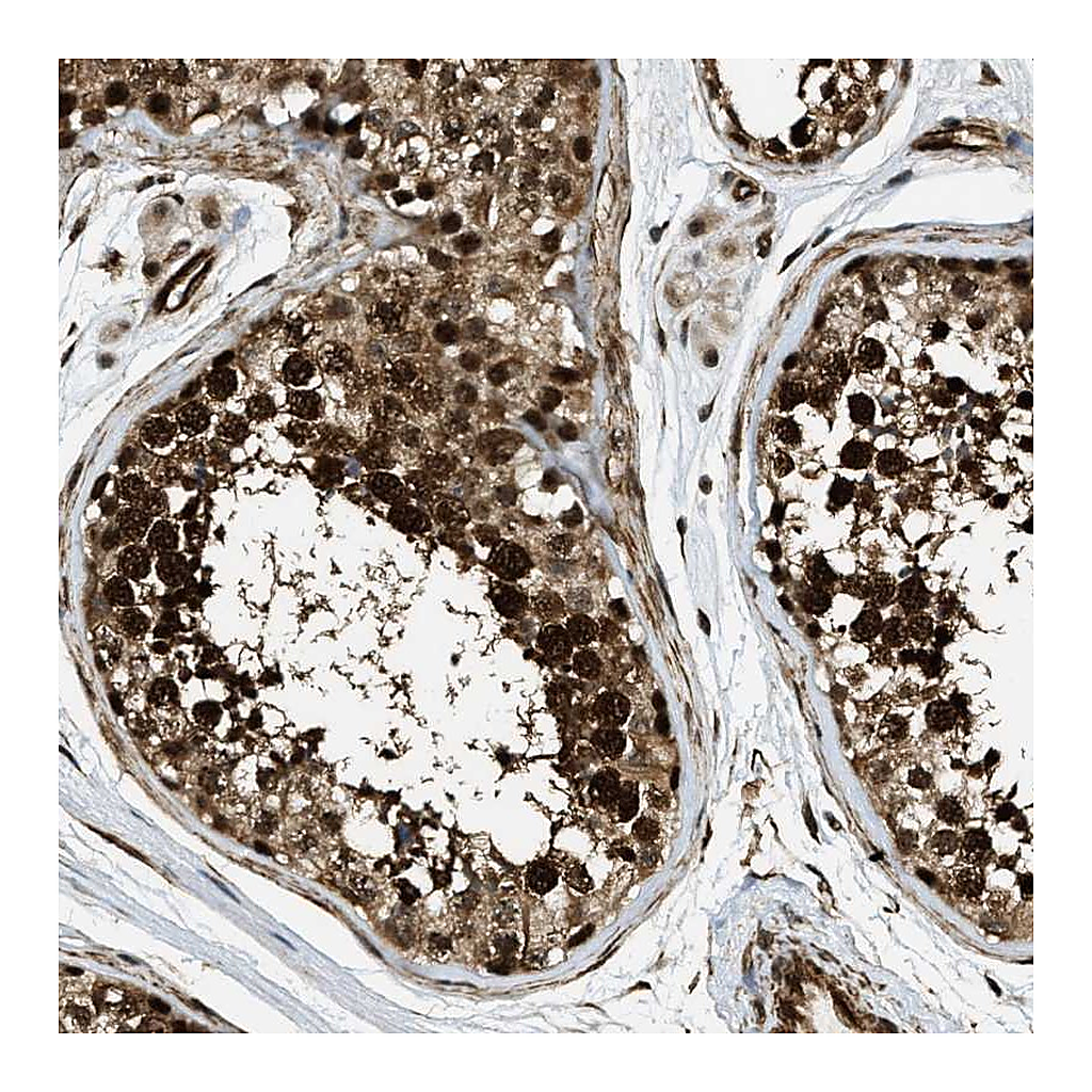 Atlas Antibodies Anti-CFAP36 Antibody