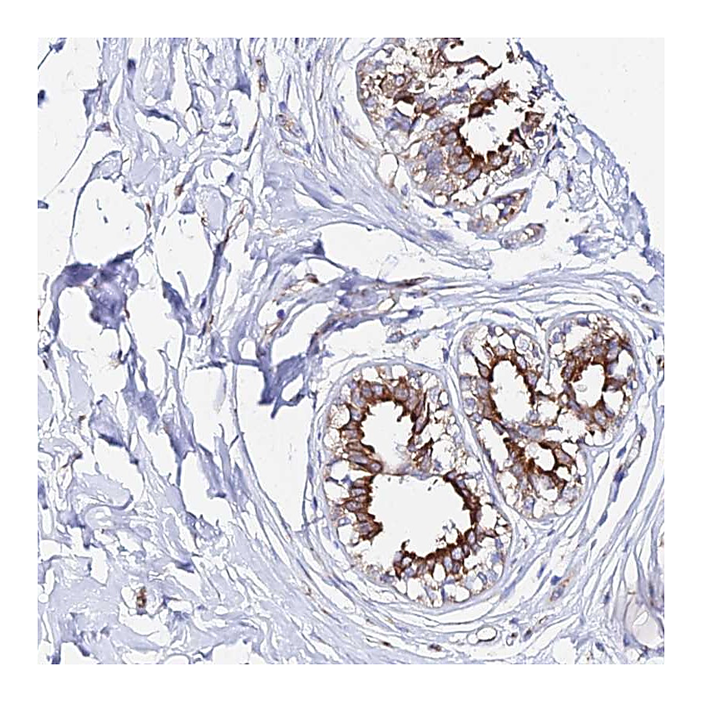 Atlas Antibodies Anti-CFAP45 Antibody
