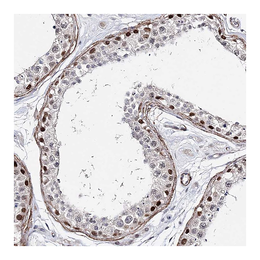 Atlas Antibodies Anti-CFAP46 Antibody