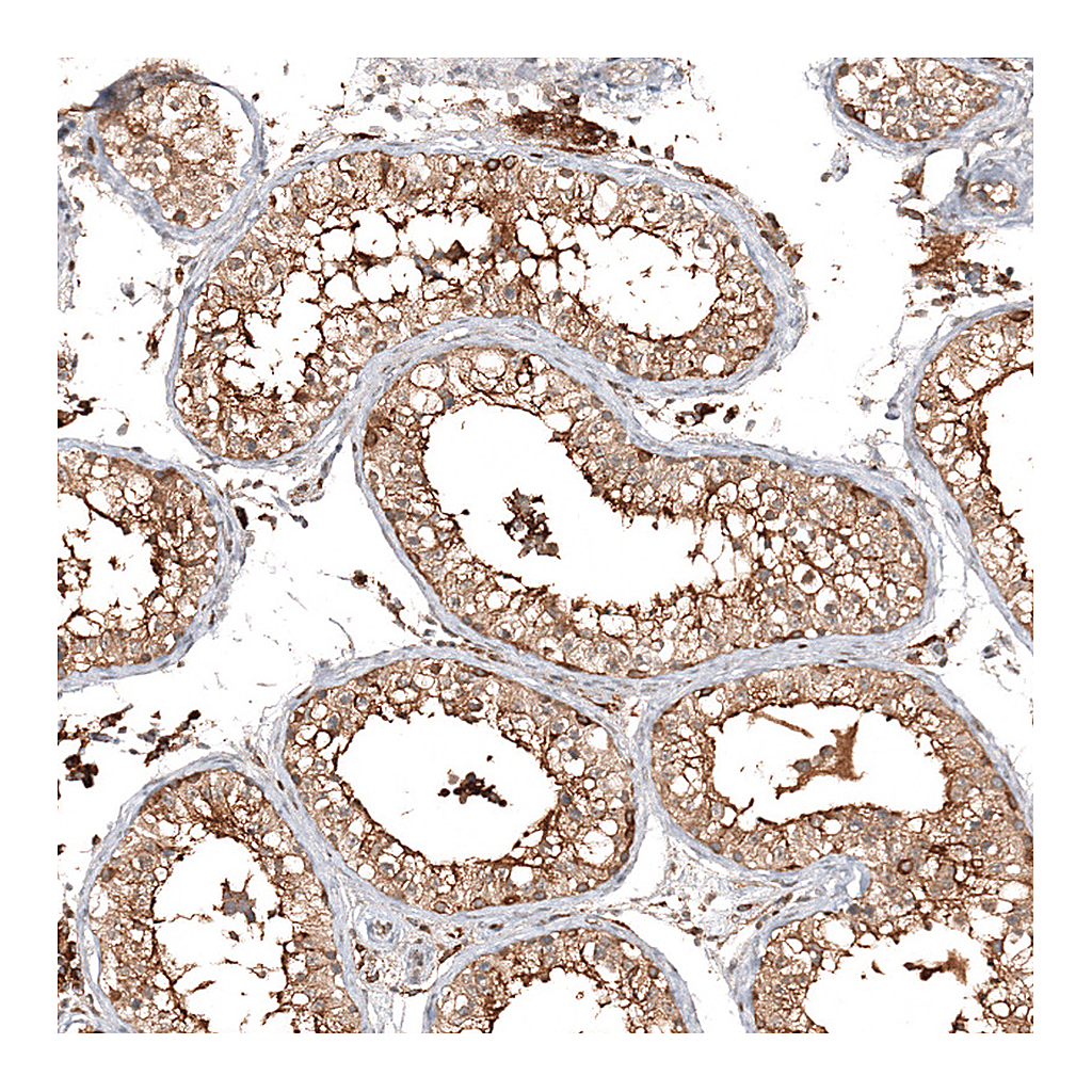 Atlas Antibodies Anti-CFAP46 Antibody