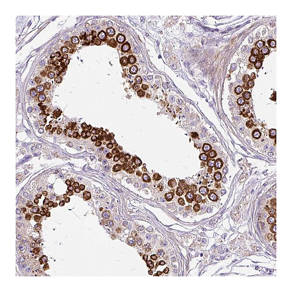 Atlas Antibodies Anti-CFAP47 Antibody