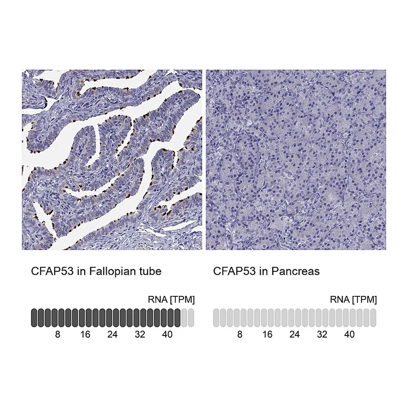 Atlas Antibodies Anti-CFAP53 Antibody