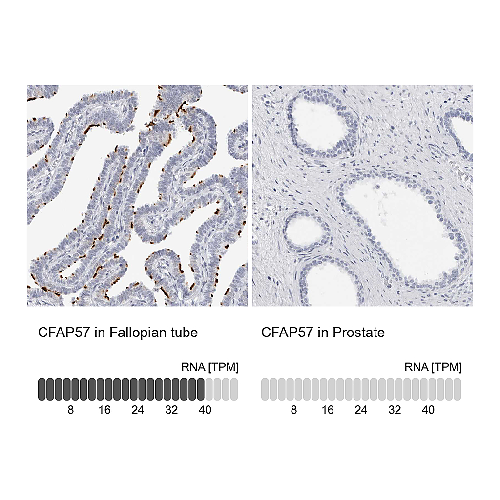 Atlas Antibodies Anti-CFAP57 Antibody