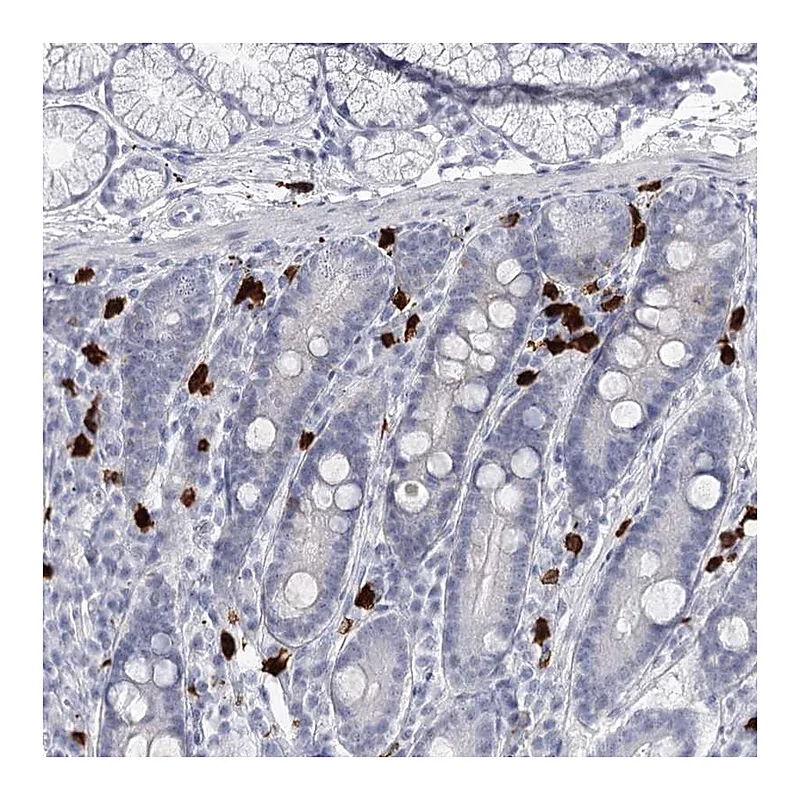 Atlas Antibodies Anti-CFAP58 Antibody