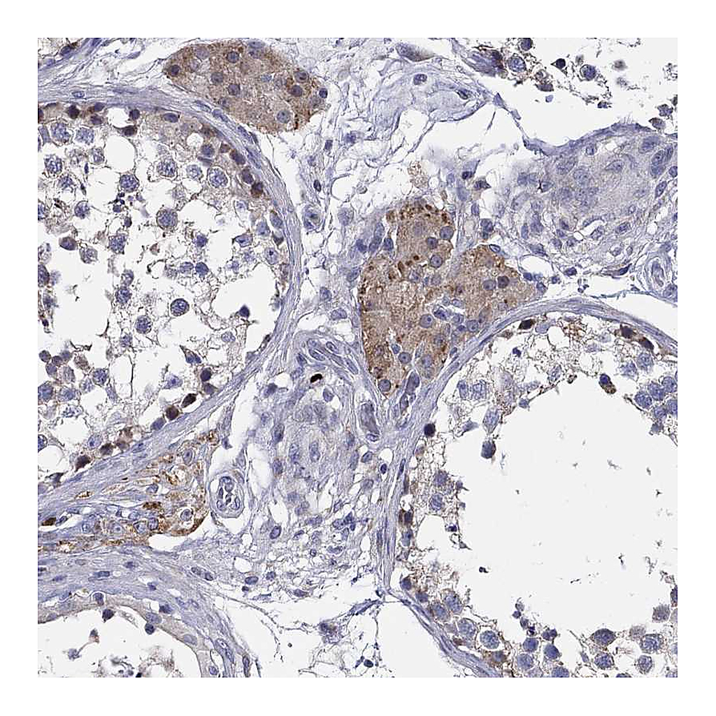 Atlas Antibodies Anti-CFAP61 Antibody