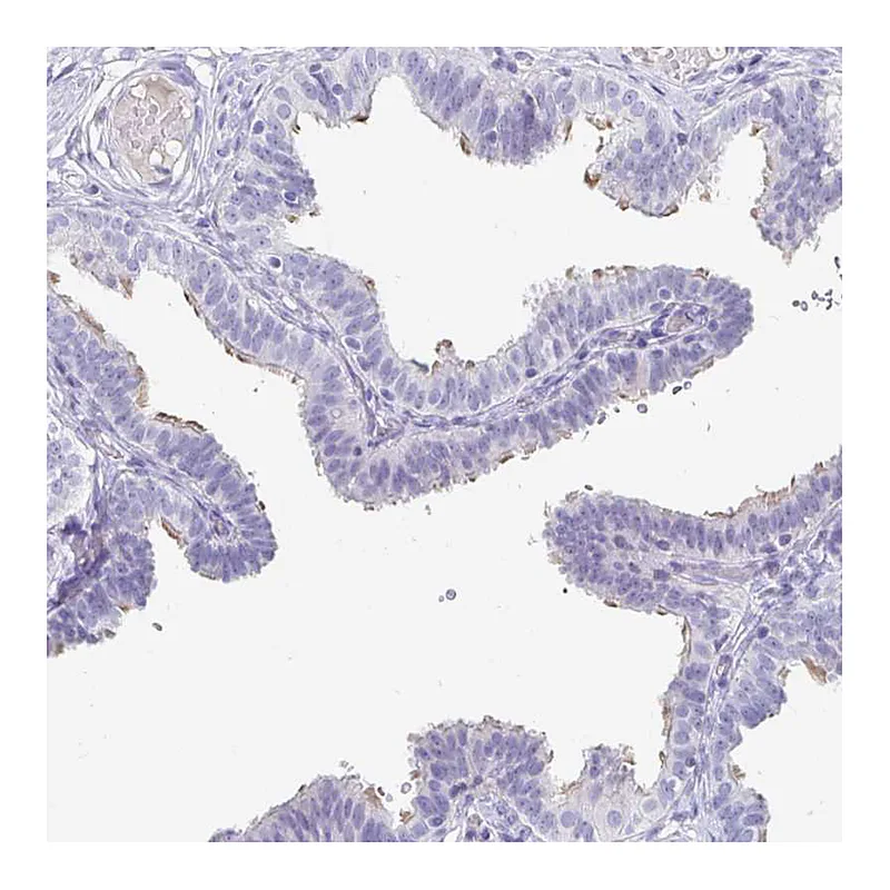 Atlas Antibodies Anti-CFAP69 Antibody