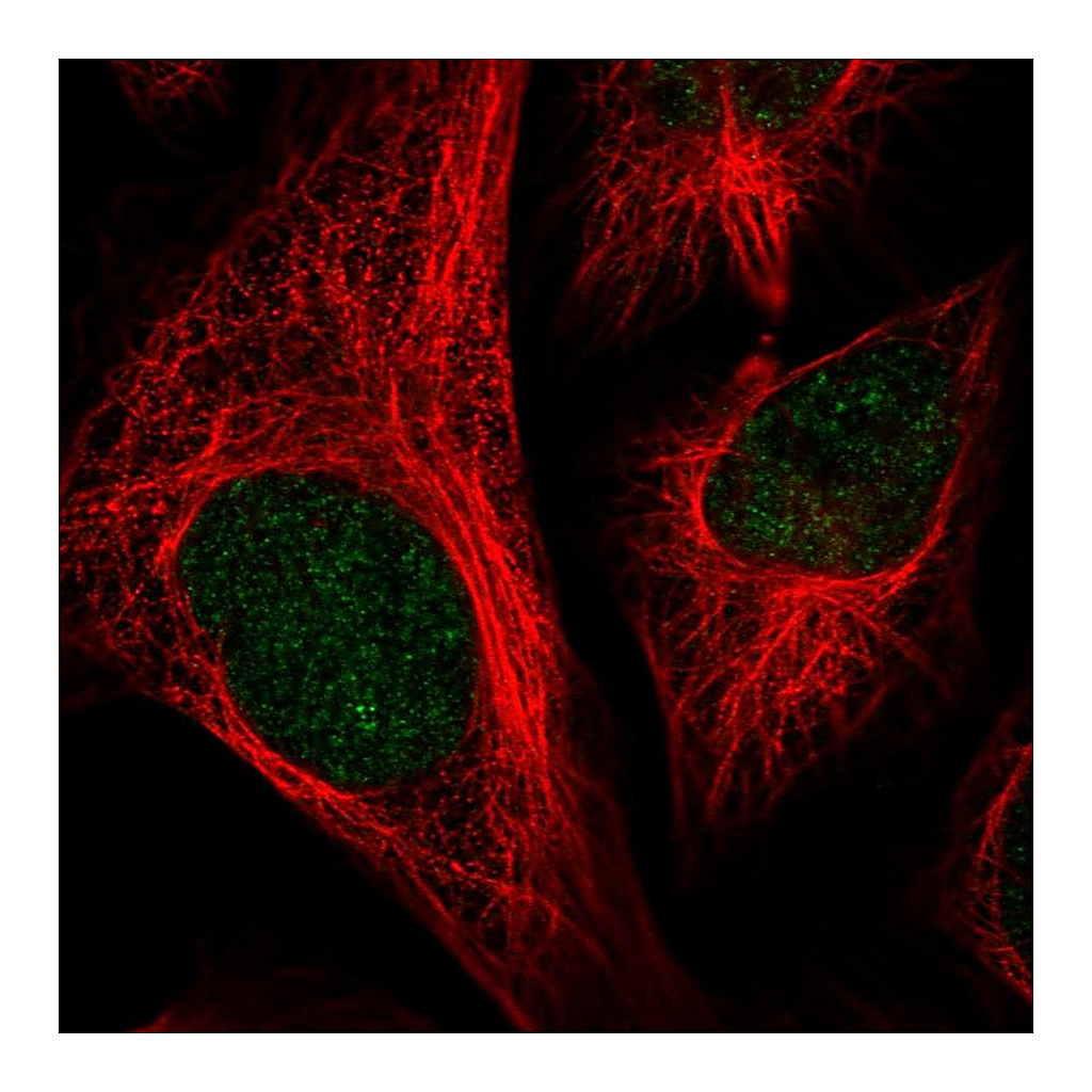 Atlas Antibodies Anti-CFAP58 Antibody