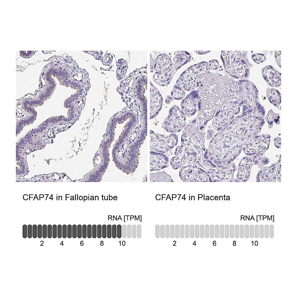 Atlas Antibodies Anti-CFAP74 Antibody