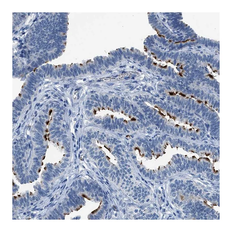 Atlas Antibodies Anti-CFAP77 Antibody