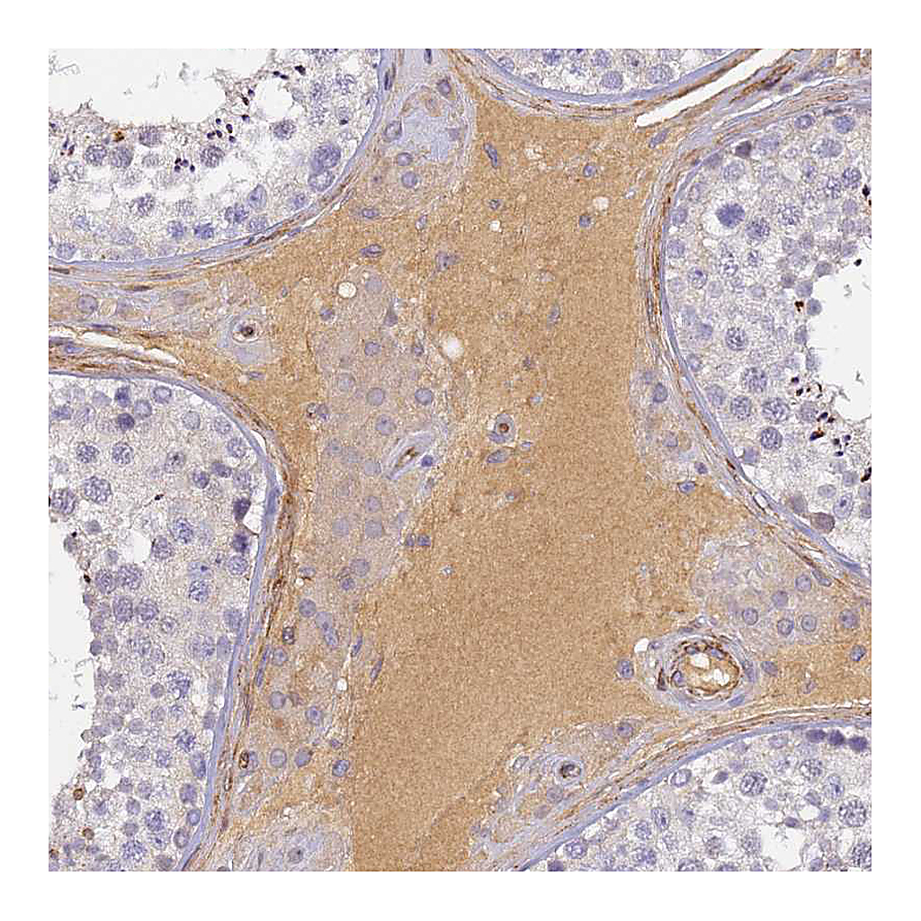 Atlas Antibodies Anti-CFHR1 Antibody