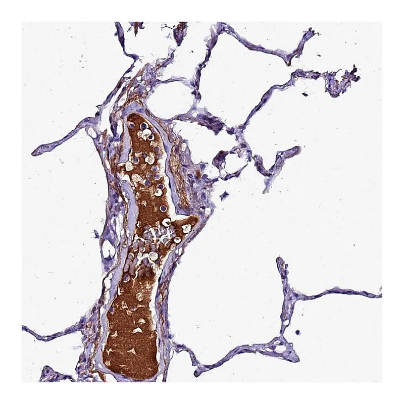 Atlas Antibodies Anti-CFHR1 Antibody