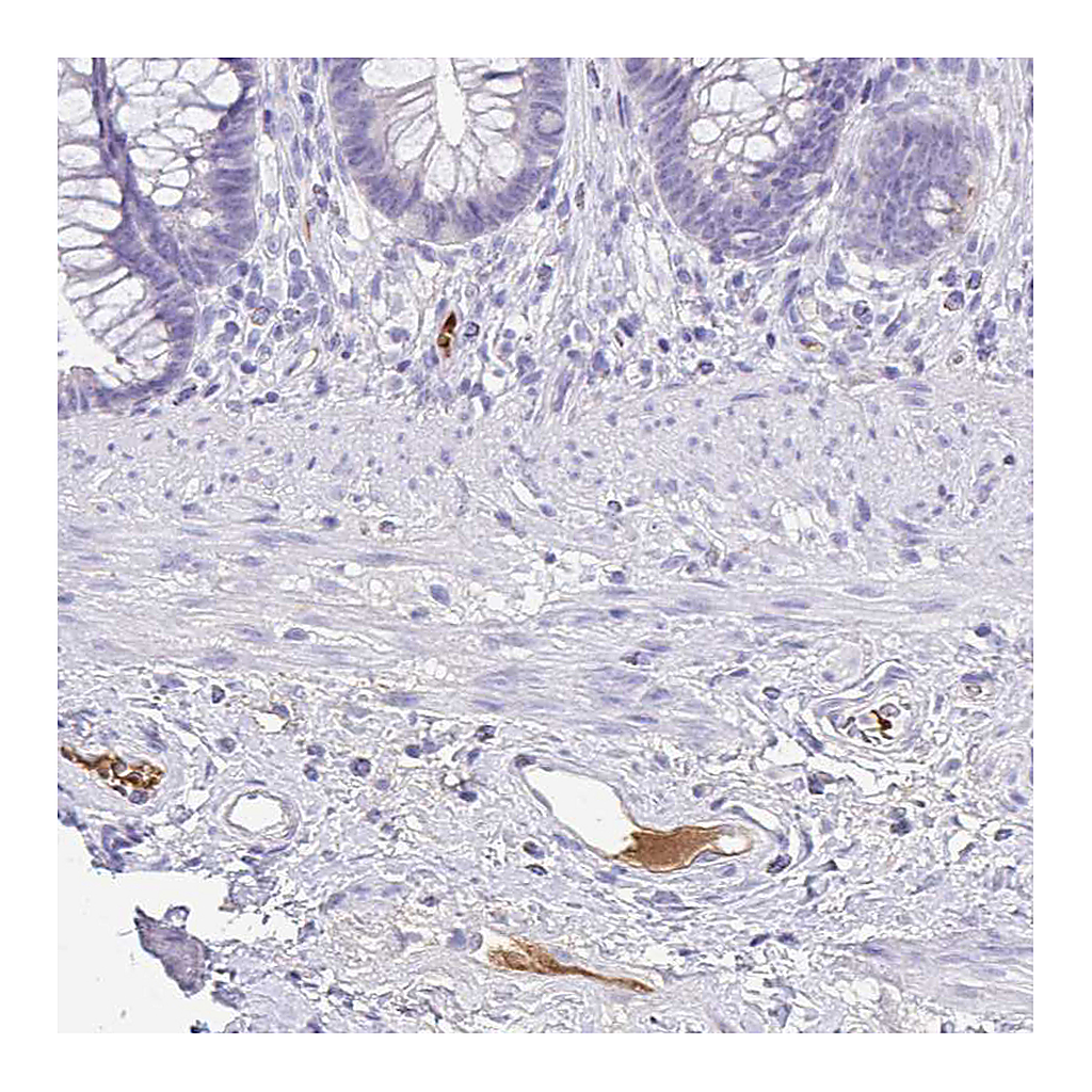 Atlas Antibodies Anti-CFH Antibody