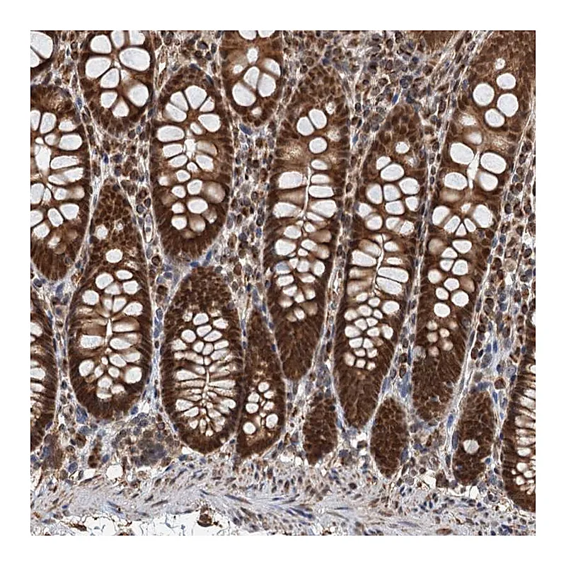 Atlas Antibodies Anti-CFDP1 Antibody