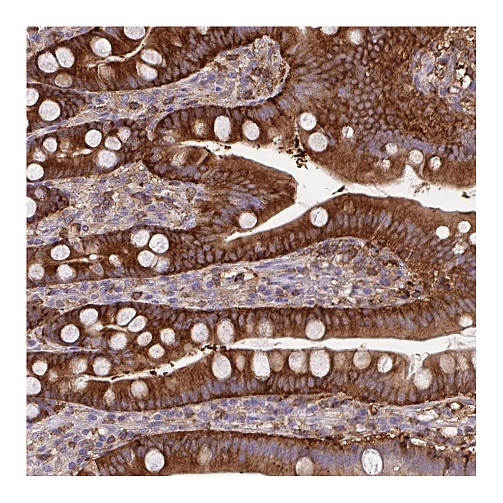 Atlas Antibodies Anti-CFL1 Antibody
