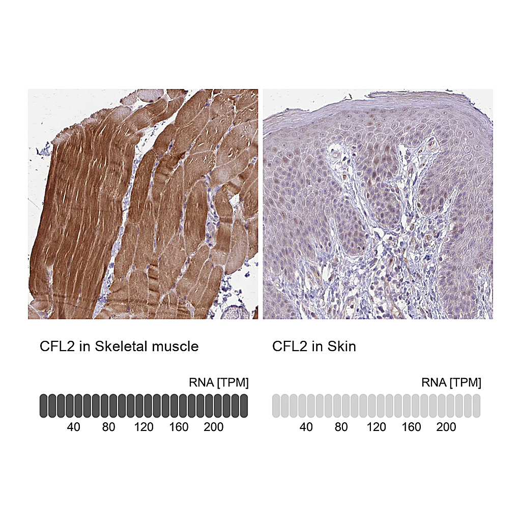 Atlas Antibodies Anti-CFL2 Antibody