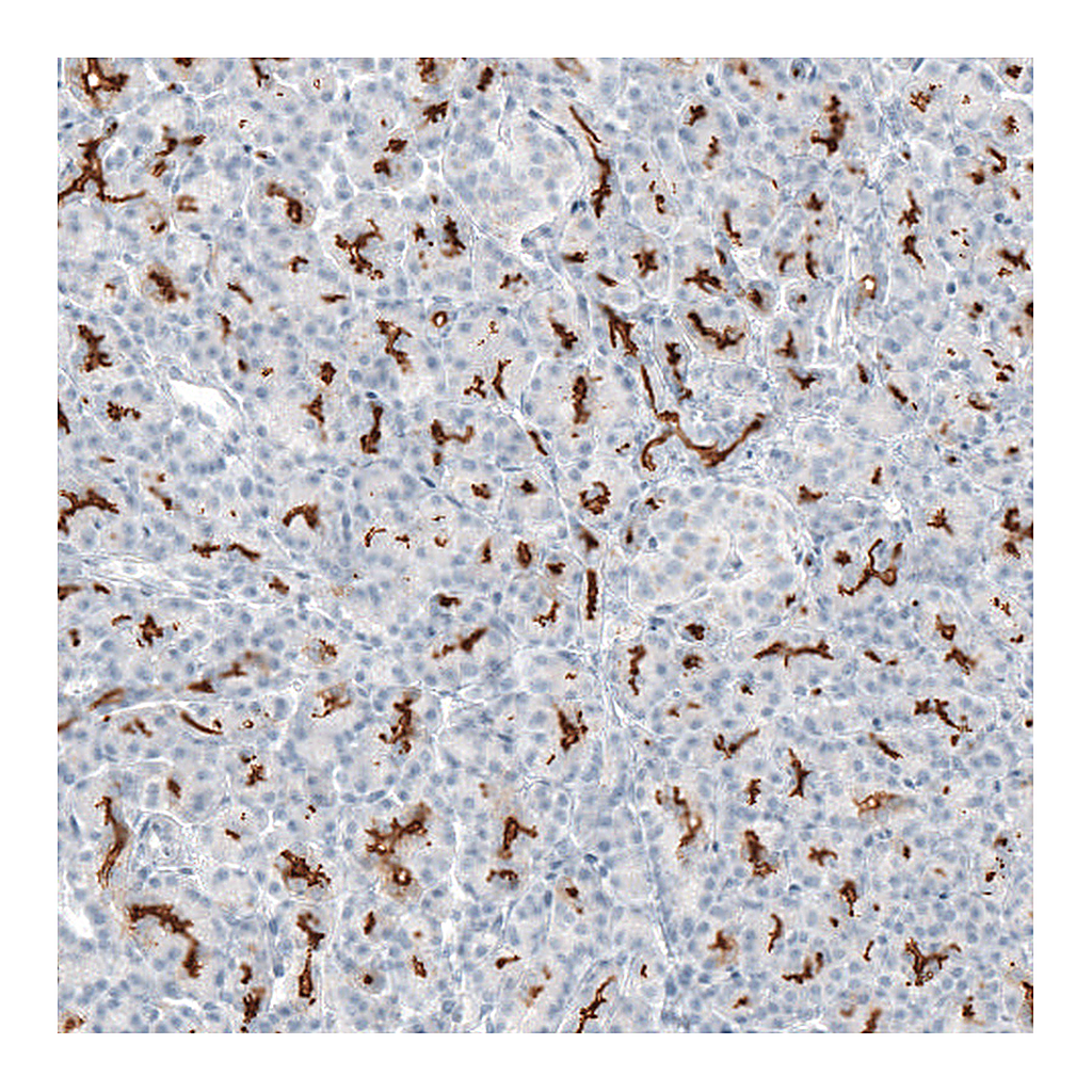 Atlas Antibodies Anti-CFTR Antibody
