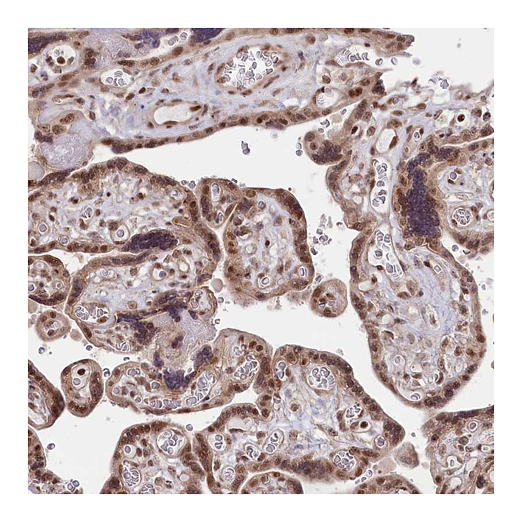 Atlas Antibodies Anti-CGGBP1 Antibody