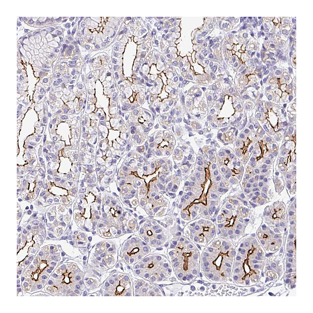 Atlas Antibodies Anti-CGNL1 Antibody