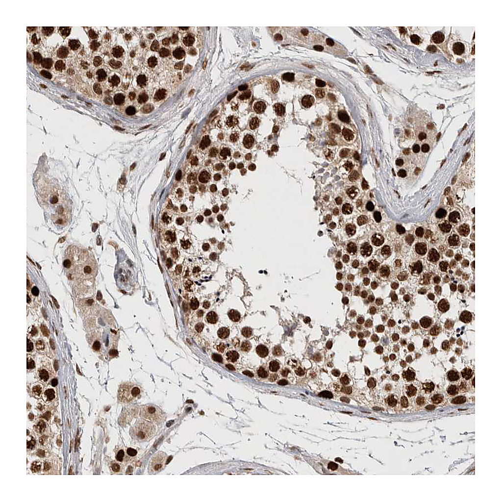 Atlas Antibodies Anti-CHAF1B Antibody