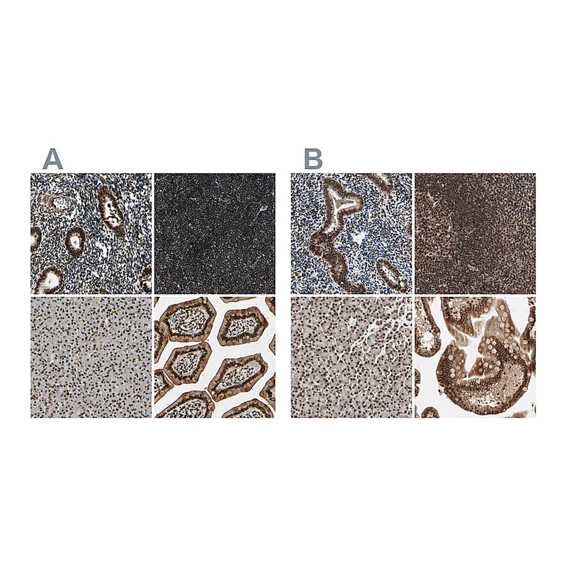 Atlas Antibodies Anti-CHAMP1 Antibody