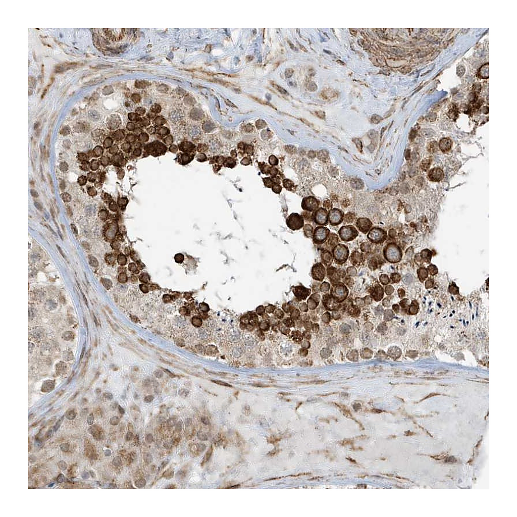 Atlas Antibodies Anti-CHCHD4 Antibody
