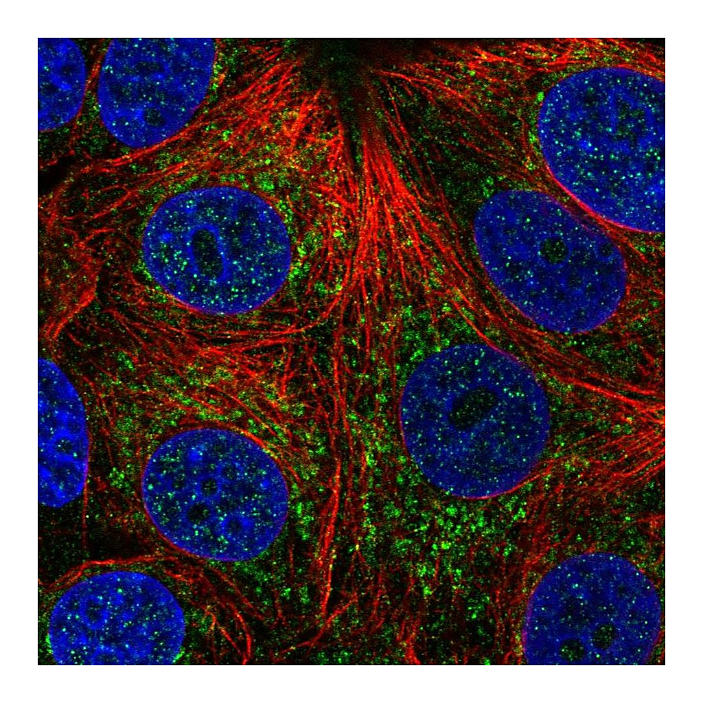 Atlas Antibodies Anti-CHCHD4 Antibody