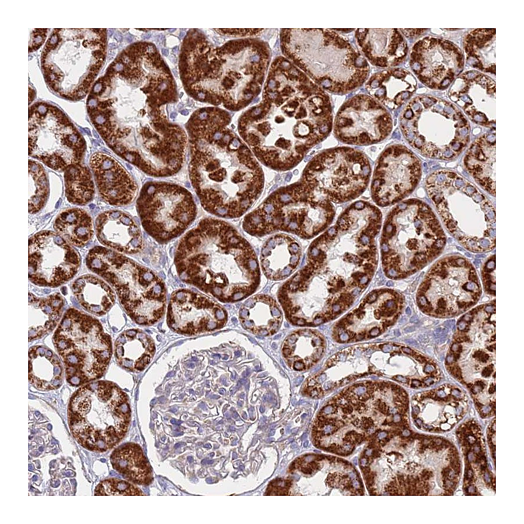 Atlas Antibodies Anti-CHCHD6 Antibody