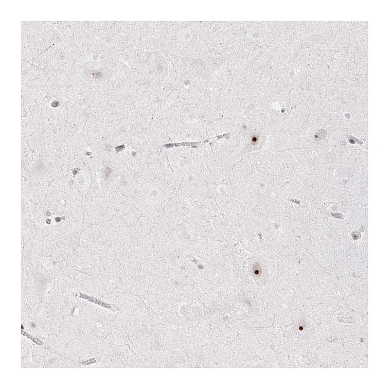 Atlas Antibodies Anti-CHD2 Antibody