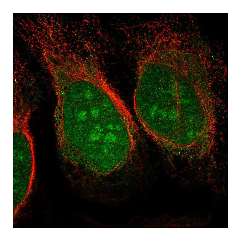 Atlas Antibodies Anti-CHD3 Antibody