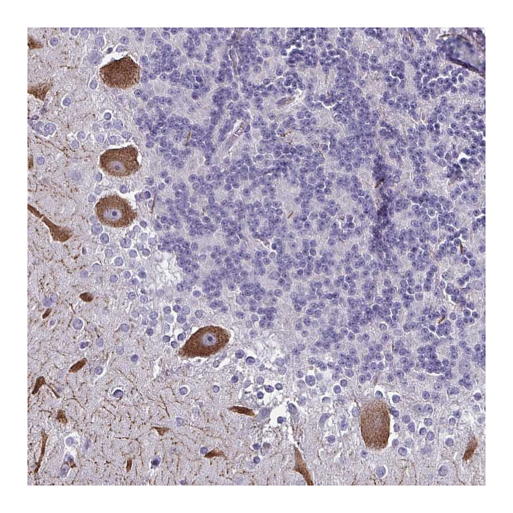 Atlas Antibodies Anti-CHD5 Antibody