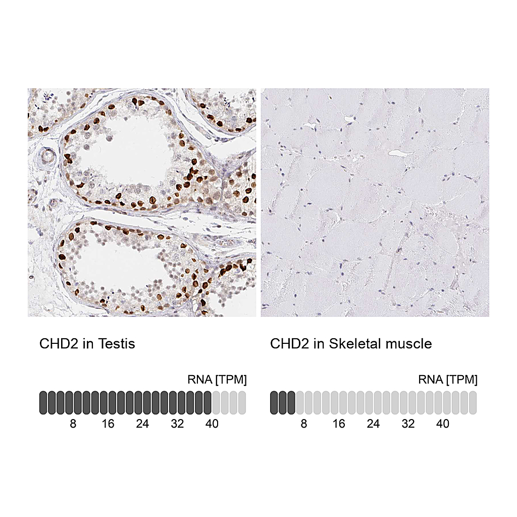 Atlas Antibodies Anti-CHD2 Antibody