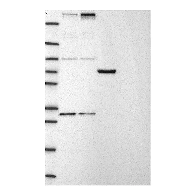 Atlas Antibodies Anti-CHD8 Antibody