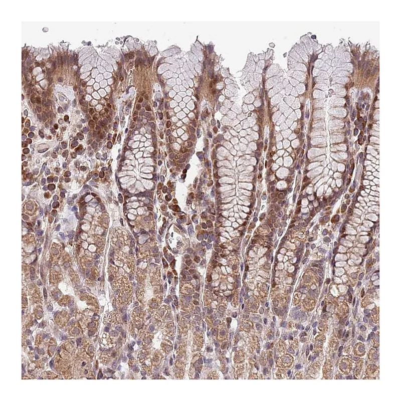 Atlas Antibodies Anti-CHD9 Antibody