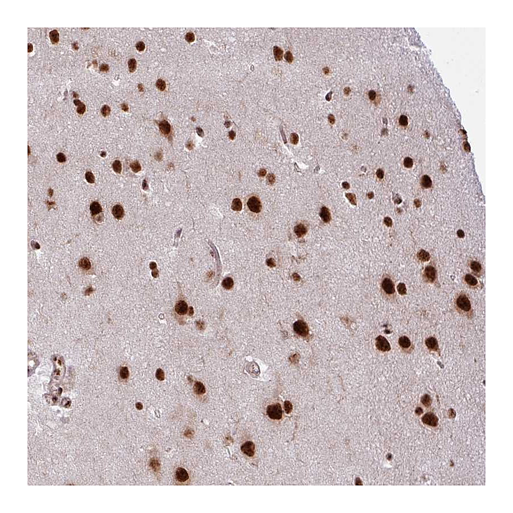 Atlas Antibodies Anti-CHERP Antibody