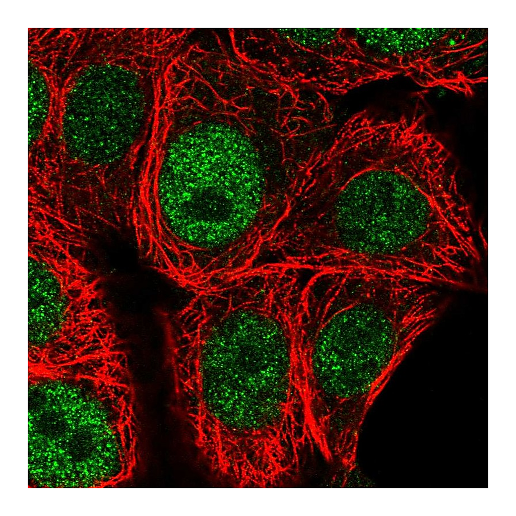 Atlas Antibodies Anti-CHEK1 Antibody