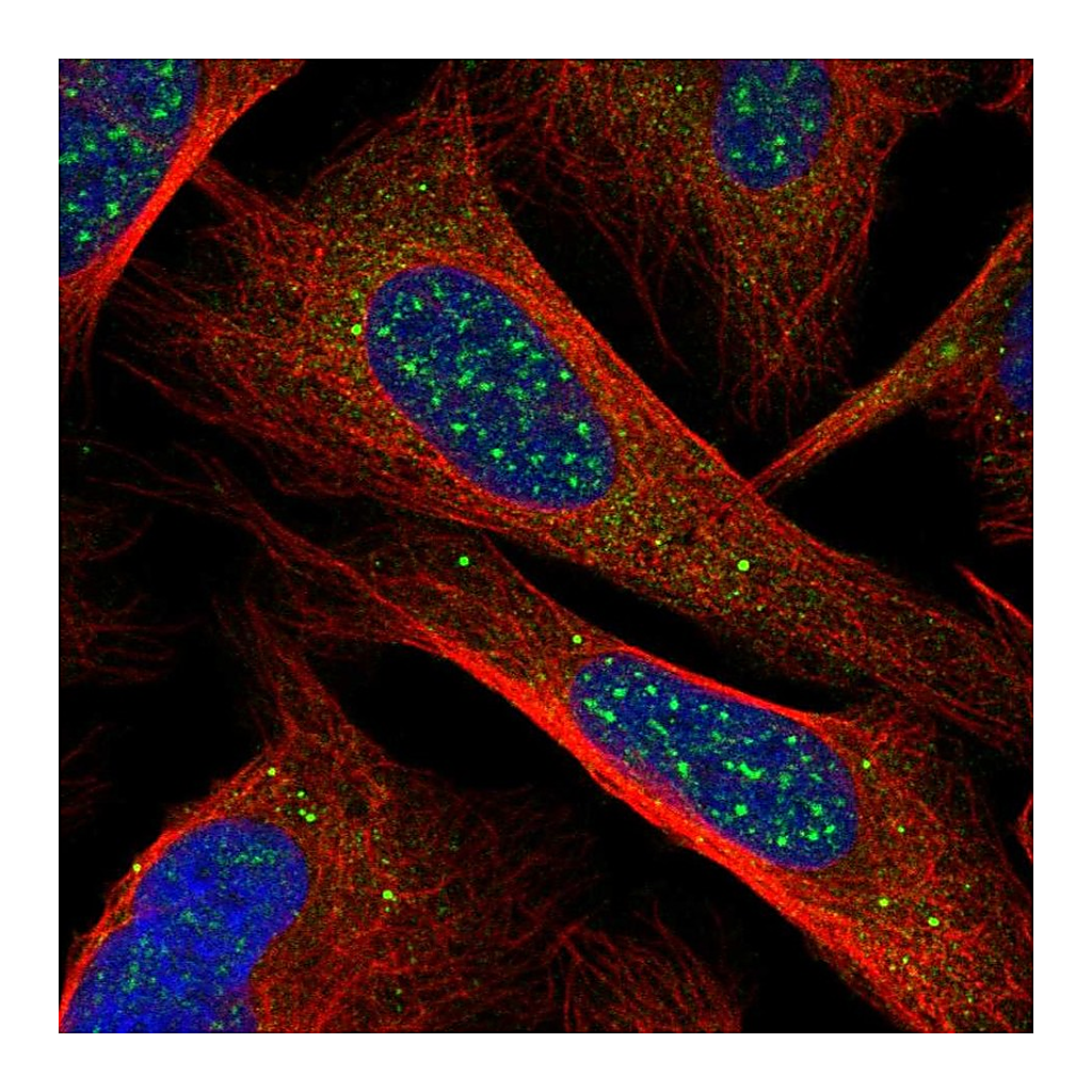 Atlas Antibodies Anti-CHIC1 Antibody