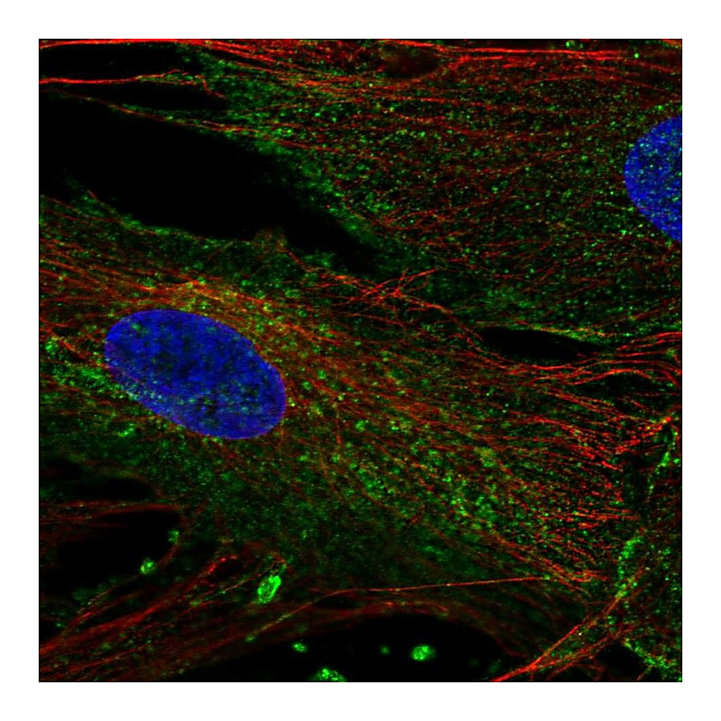 Atlas Antibodies Anti-CHIC2 Antibody