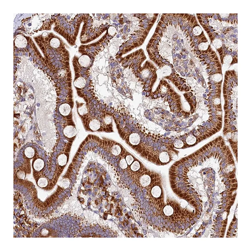 Atlas Antibodies Anti-CHID1 Antibody