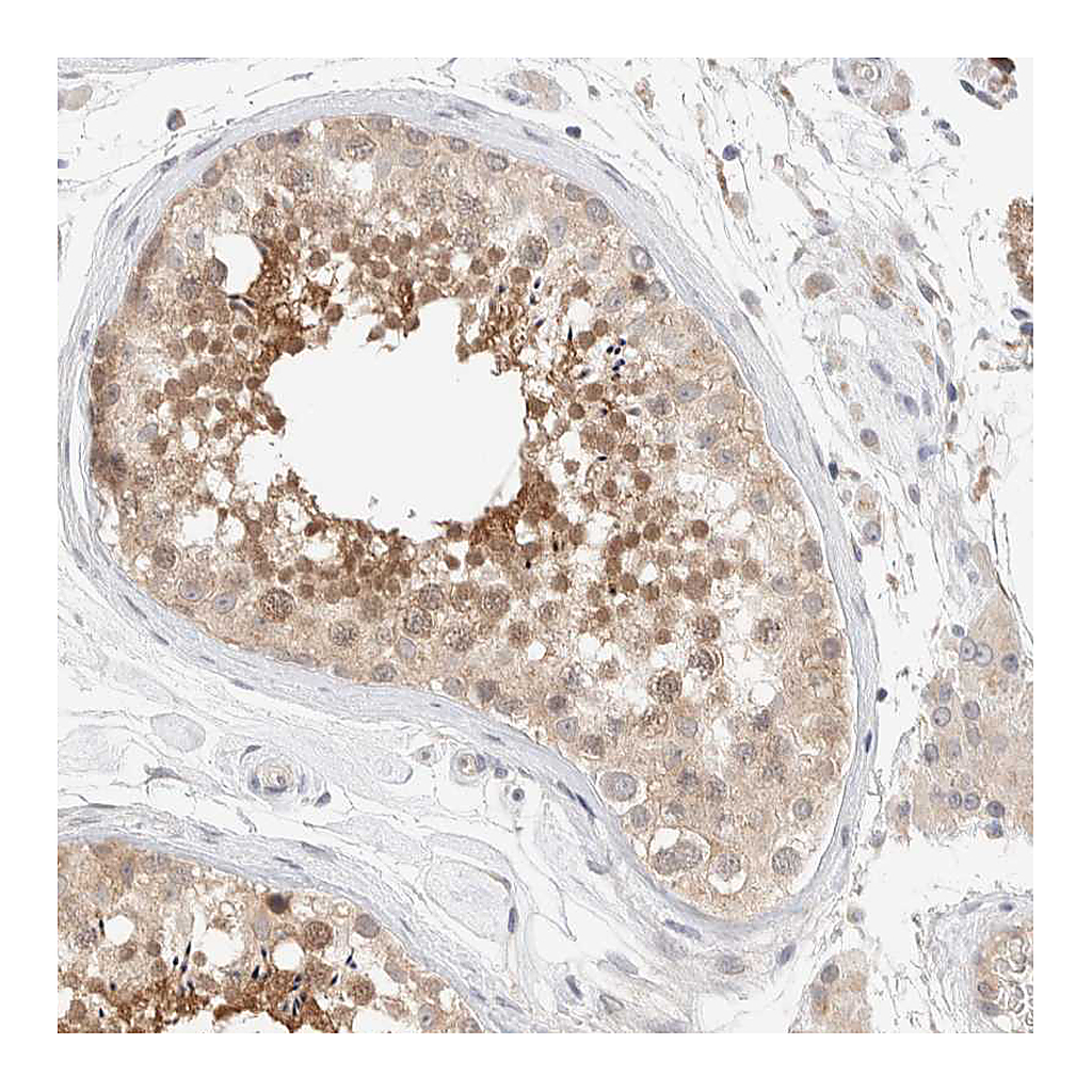 Atlas Antibodies Anti-CHKA Antibody