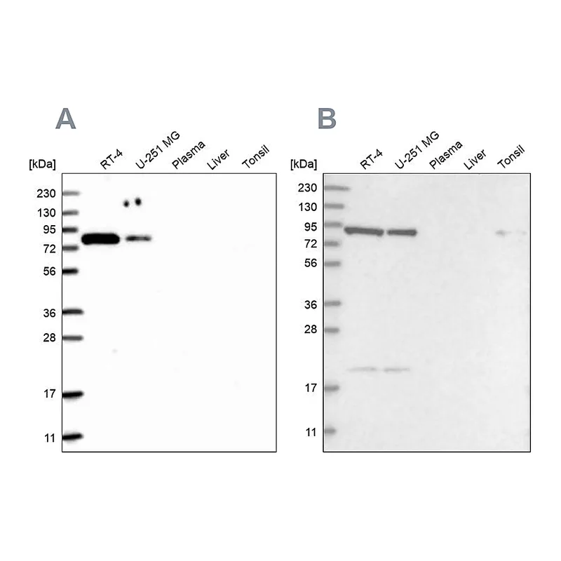 Atlas Antibodies Anti-CHML Antibody