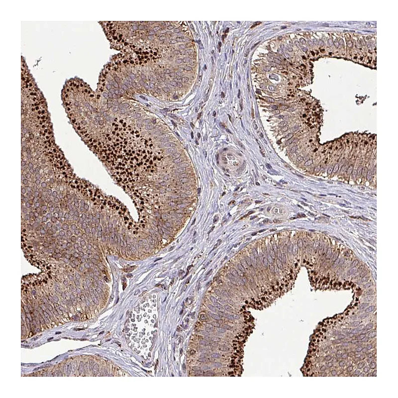 Atlas Antibodies Anti-CHMP1B Antibody